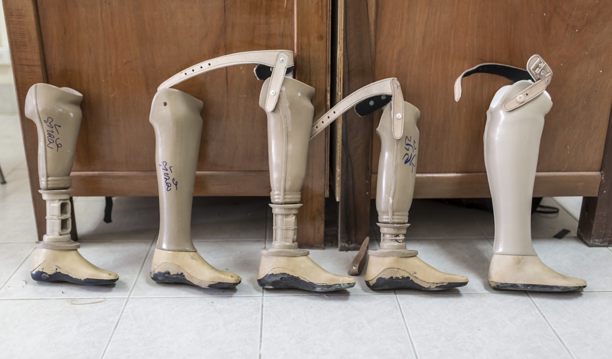 VIENTIANE, LAOS - NOVEMBER 05: A collection of artificial lower legs at COPE, the documentation and rehabilitation centre for the victims of landmines and cluster munitions, on  November 05, 2012 in Vientiane, Laos. (Photo by Thomas Imo/Photothek via Getty Images)