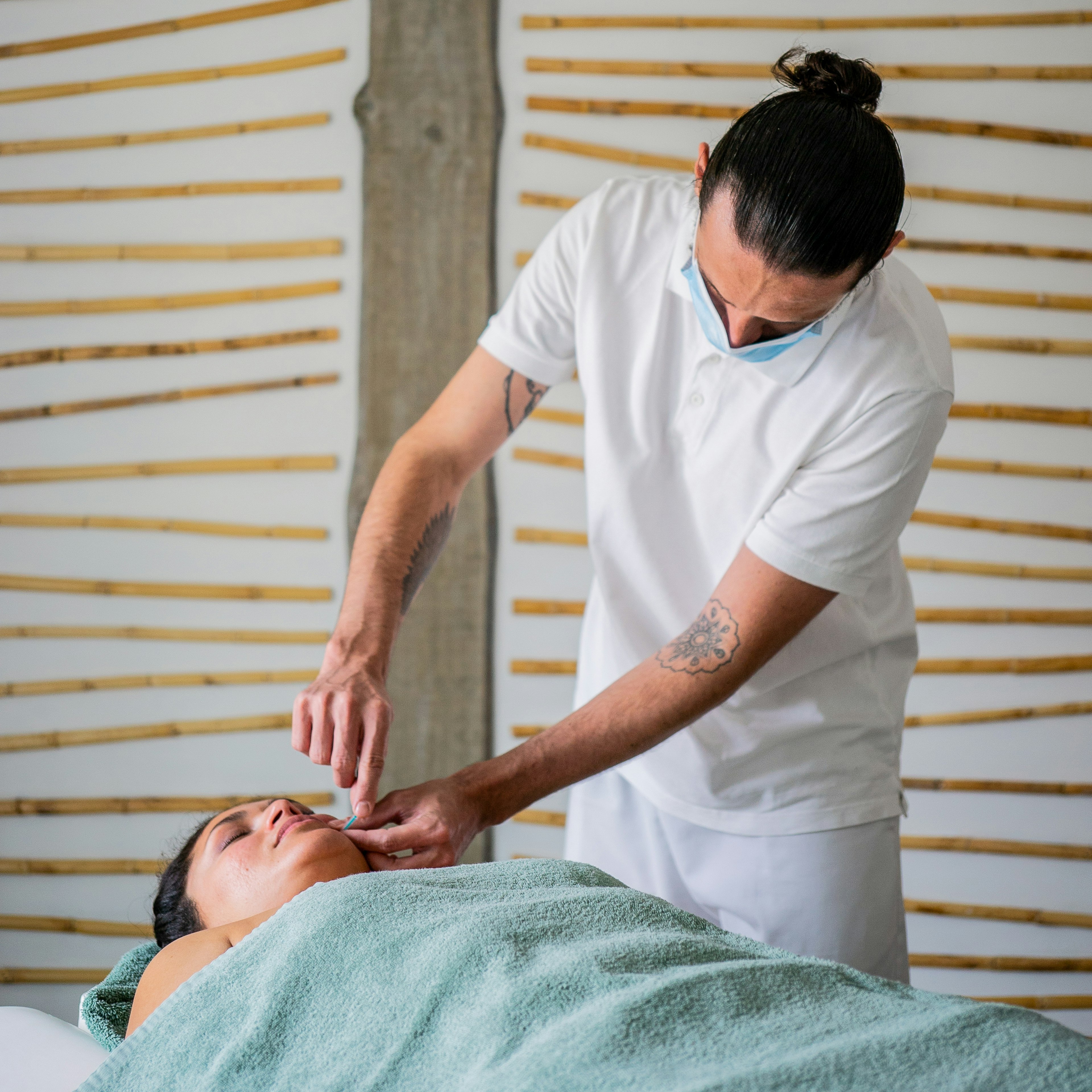 A guest at a hotel receiving an acupuncture treatment.