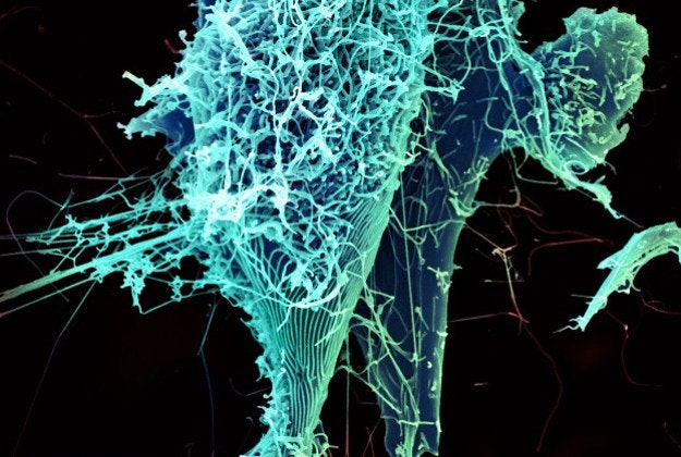 Ebola virus.