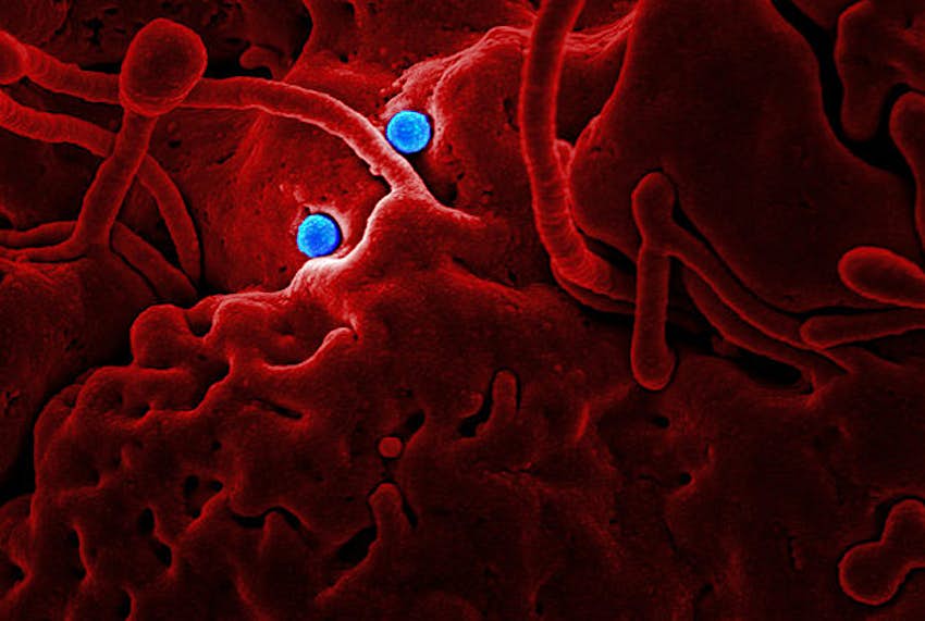 Travel News - Mers NIAID Mers cornavirus particles.
