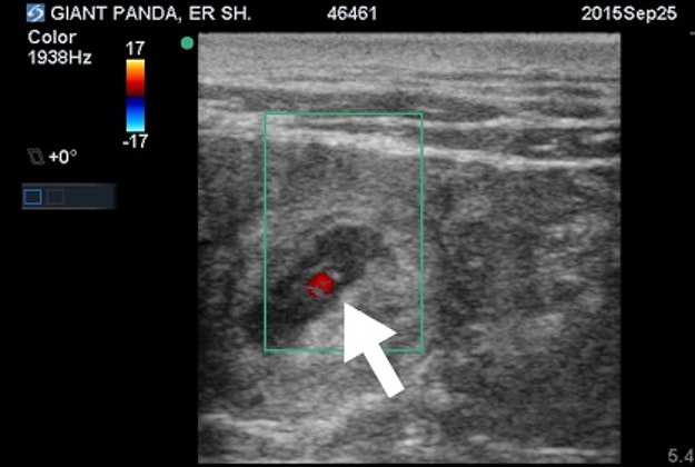 The first ultrasound of Er Shun shows a heartbeat.