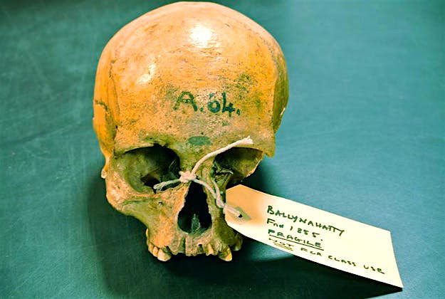 Travel News - irish ancestry Photo issued by Trinity College Dublin of the skull of a farmer woman who lived near Belfast 5,200 years ago. The woman had ancestry that could be tracked to the Middle East, where agriculture was invented.
