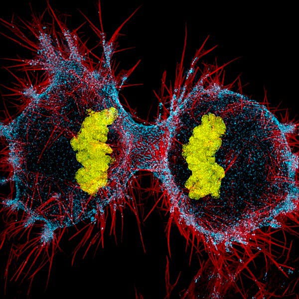 Travel News - human-hela-cell-immortal-cells-used-in-scientific-research-undergoing-cell-division 12th place
