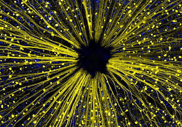 Travel News - retinal-ganglion-cells-of-a-mouse 14th place