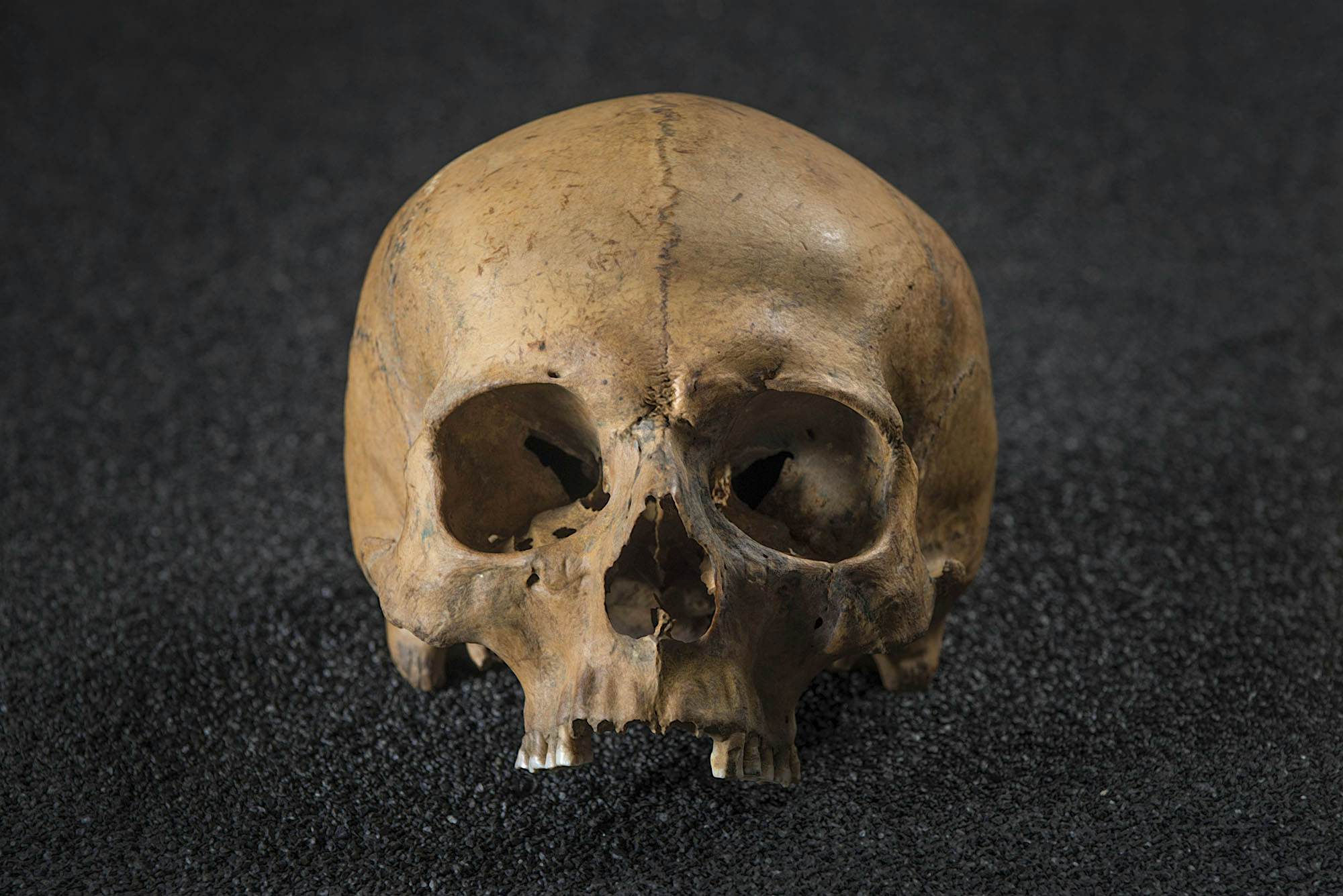 Travel News - Four to five skulls of men showing signs of violent death © Museum of London Four to five skulls of men showing signs of violent death